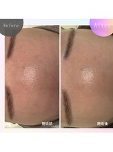 クリア 麻布十番(CLEAR)/ダクトピール　酸不使用　艶美肌