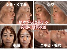 アンティアージュ 福岡本店(antiage)