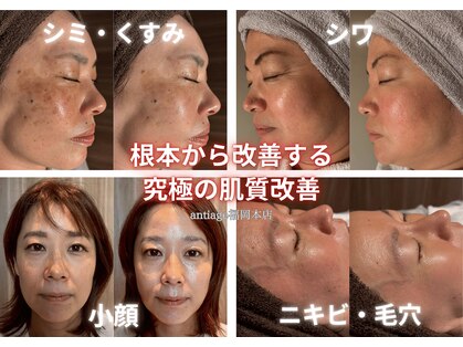 アンティアージュ 福岡本店(antiage)の写真