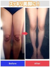 カルミア 心斎橋店/美脚コース/40代のお客様