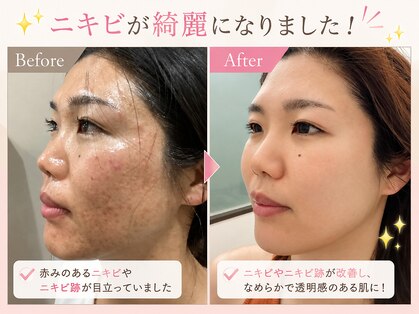 ルボン(RUBON)の写真
