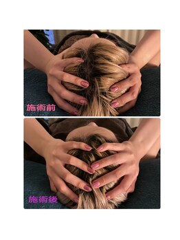 ミコット/ドライヘッドスパの変化