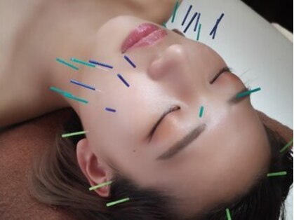 にしむら接骨院 和白院の写真