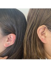 アールラッシュ(R-LASH)/