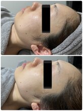 ラン(Ran)/コルギAfter写真