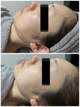 ラン(Ran)/コルギAfter写真