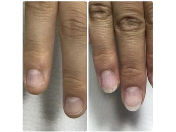 3ヶ月のbefore、after