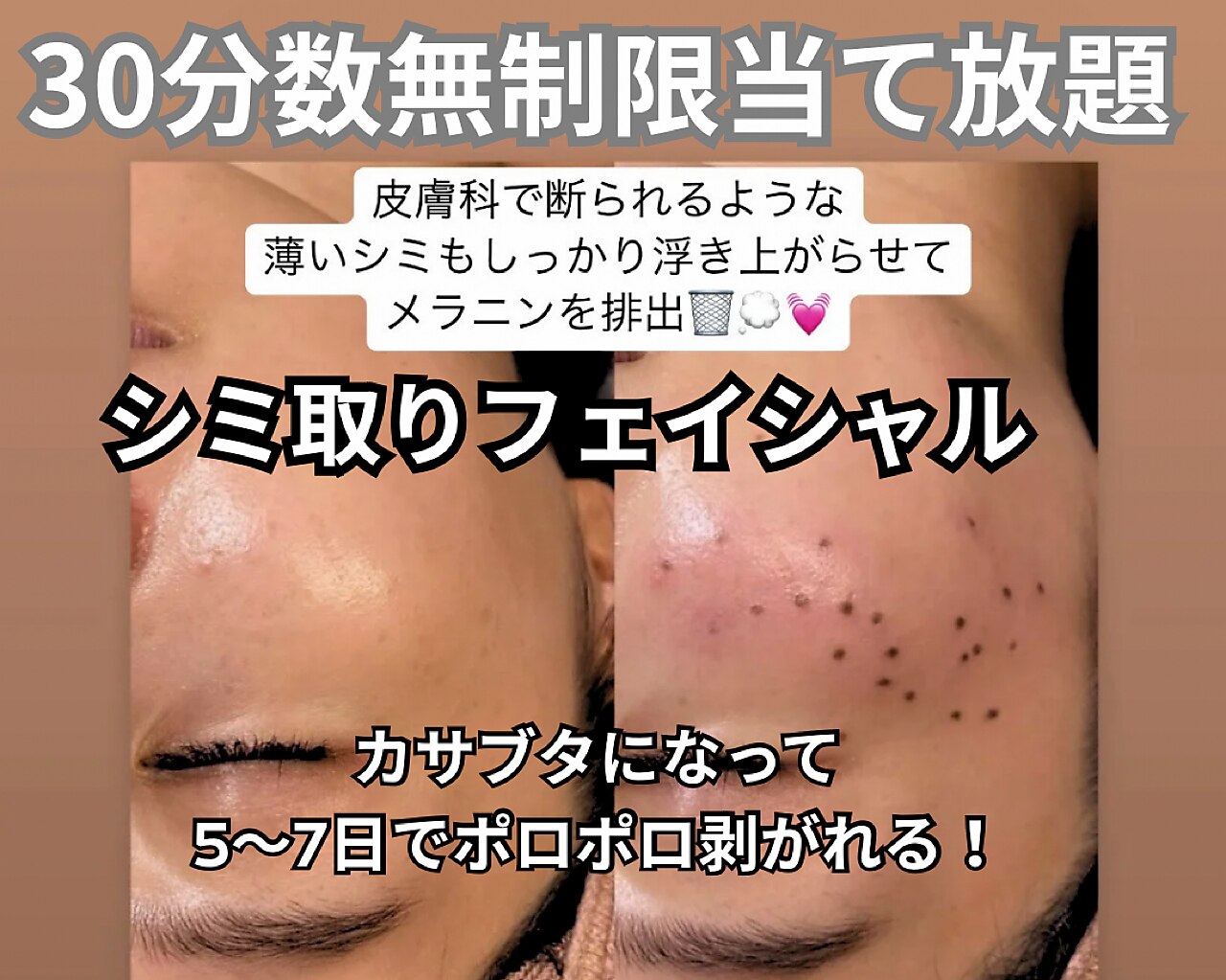 ひたちなか市でEMSが人気のエステサロン｜ホットペッパービューティー