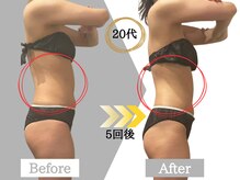 ジャパ(JAPA)/人気No.1ハイパーナイフ痩身