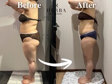 ヘルバ(HERBA)/痩身