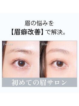 オールウェーズキュア バイ ビオナス(Always CURE.by BIONAS)の写真/【話題のHBL】今までになかった新技術!!眉毛のお悩みやコンプレックスをその日即座に解消◎