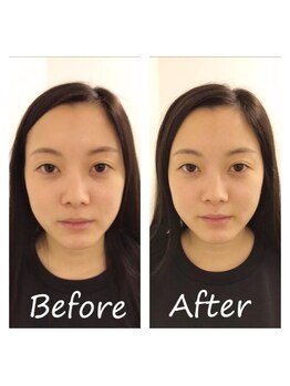 骨盤ストレッチ整体 b/小顔矯正★変化写真