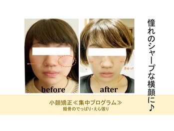 ナネア/短時間で小顔にします。