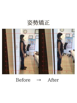 心斎橋長堀フェムテック整骨院/43姿勢矯正　骨格矯正と骨盤矯正