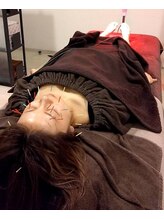 ウェルビープラーカ(Well-beプラーカ)/冷えはお顔のくすみの原因に。