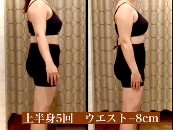 サロン セドナ(SALON SEDONA)/上半身リンパ痩身 5回ブライダル