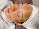 マイスタジオ(MY studio)の写真/フラーレン配合オリジナルのマツヤニ"Belle Skin Wax"で様々な肌悩みを改善◎脱毛だけでなく美肌へ導きます