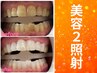 【会員／回数券】８分×2回美容セルフホワイトニング