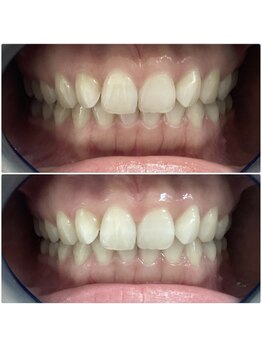 エスプライザ 鹿児島天文館店(ESPLIZA)/