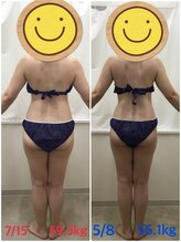 エスティフル 狭山店(ESTIFUL)/[痩身エステ]Before/After