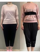 ホリック アイス コア ボディ(HOLIC ICE CORE BODY)/お客様のビフォーアフター11