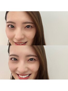 エイル ビューティ スタジオ(EIL beauty studio)/