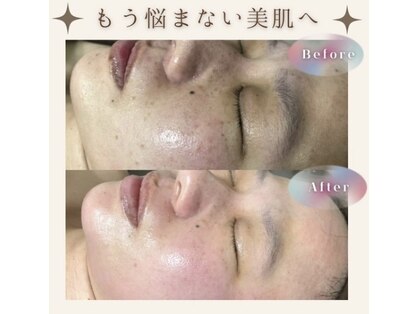 アカアカ(aka'aka)の写真