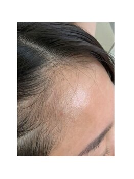 キュライム カブール町田店/前髪で隠さないで過ごせます