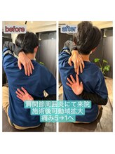 整体サロン　アンティオール　大森本店【頭痛/不眠/耳鳴り/腰痛/肩こり/骨盤矯正】/Before→After【肩のお悩み】