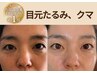 【目の下たるみ・クマ改善ケア】40代50代人気♪原因から根本ケアヘッドSPA付