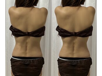 ルフレ 広島(Lufure)/女性らしい後ろ姿に仕上げます☆