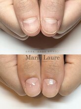 マリーロール 淀屋橋本店(Marie Laure)/自爪育成/深爪矯正/ネイルケア