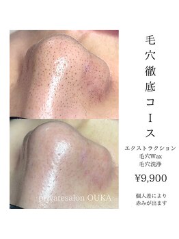 オウカ(OUKA)/毛穴掃除と白玉パックでスッキリ