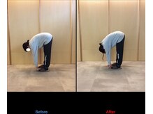 徳島藍住整骨院 ザ ビー(THE B)/ピラティス初回体験before/after