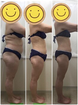 エスティフル 狭山店(ESTIFUL)/[痩身エステ]Before/After