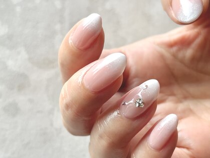 ブレスネイル(brace Nail)の写真