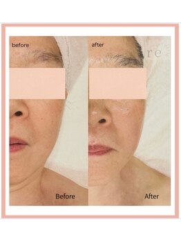 アールイー(re)/リフトアップマッサージ