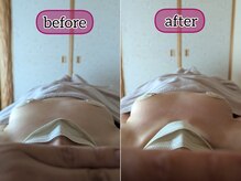 スノードロップ(snowdrop)/