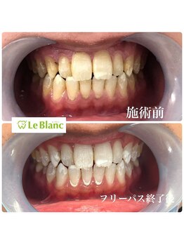 ルブラン 奈良店(Le Blanc)/3週間通い放題!