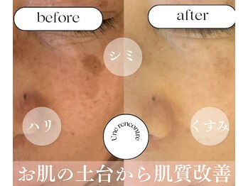 ユヌランコント 岐阜店(Une rencontre)