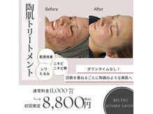 ベルシー(BELTHY)