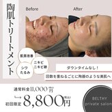 ベルシー(BELTHY)