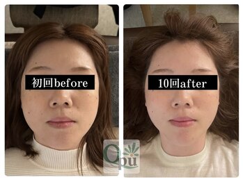 キュープ 富士店(Qpu)/ダイエットなしでも！