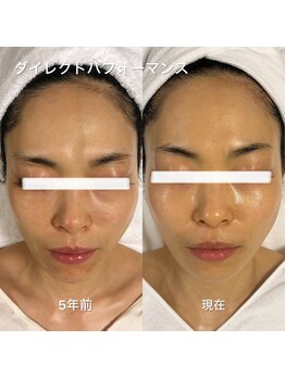 デディア 恵比寿(dedia)/レチノール若見えマイナス5歳肌