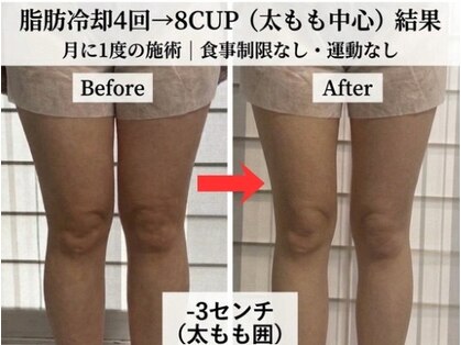 グランドール(Grandeur)の写真