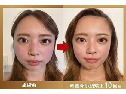 グレースフィオーレ 横浜店(gracefiore)の写真