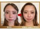 グレースフィオーレ 横浜店(gracefiore)の写真