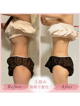 パラアモール(Paraamor)/骨や筋肉の位置も整うフェムケア