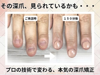 アニューの写真