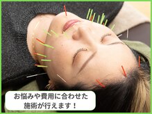 晴々の雰囲気（お悩みに合わせた施術をご提供できます！費用面も相談可能！）